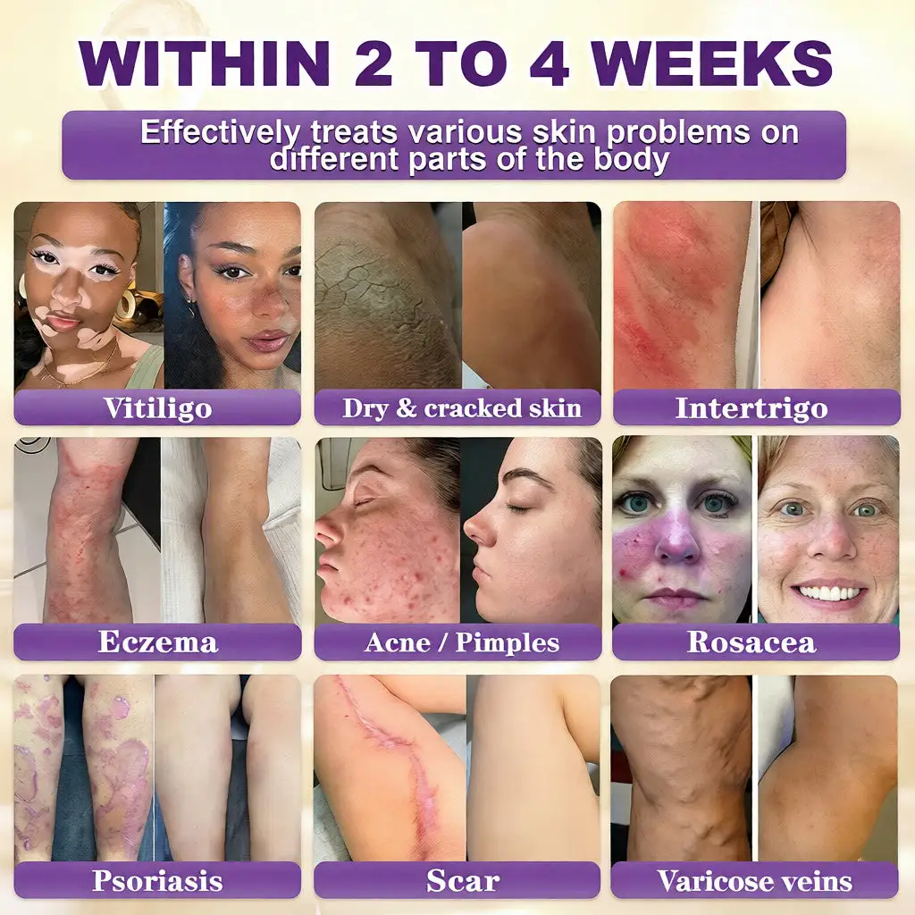 Made and Shipped from USA ✨Tiworld™ Biotin 10-in-1 Skin Restoration Cream 🍀