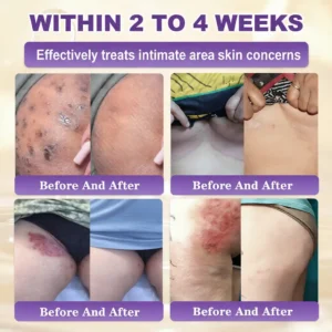 Made and Shipped from USA ✨Tiworld™ Biotin 10-in-1 Skin Restoration Cream 🍀