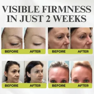 👏🌿Proudly Made in the USA💫Tiworld® Advanced Peptide Botox-Style + Vita-A Retinol Lifting Renewal Cream – Today Only 70% OFF