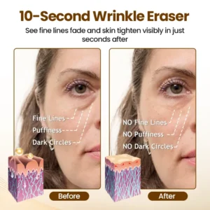 Tiworld® 10-Second Rapid Renewal Anti-Wrinkle Serum
