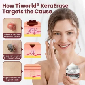 Tiworld KeraErase Dual-Action Renewal Cream | Smooth & Renew Skin Effortlessly