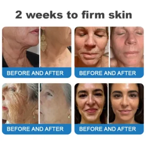 ⏰Ends Today: Buy 1 Get 1 Free! Tiworld®-Polypeptide Collagen Elastic Essence Cream