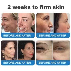 ⏰Ends Today: Buy 1 Get 1 Free! Tiworld®-Polypeptide Collagen Elastic Essence Cream