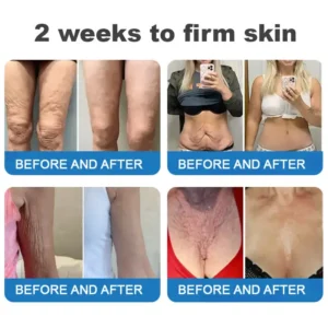 ⏰Ends Today: Buy 1 Get 1 Free! Tiworld®-Polypeptide Collagen Elastic Essence Cream