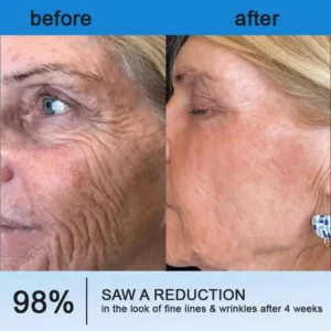 ⏰Ends Today: Buy 1 Get 1 Free! Tiworld®-Polypeptide Collagen Elastic Essence Cream