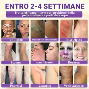 Prodotto e spedito dall’Italia ✨TiworldI® Biotin 10-in-1 Skin Restoration Cream 🍀