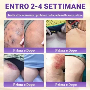 Prodotto e spedito dall’Italia ✨TiworldI® Biotin 10-in-1 Skin Restoration Cream 🍀