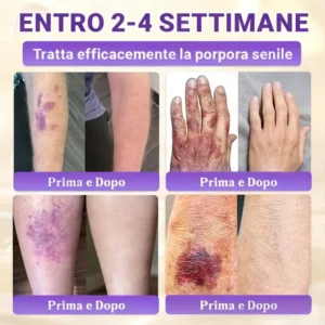 Prodotto e spedito dall’Italia ✨TiworldI® Biotin 10-in-1 Skin Restoration Cream 🍀