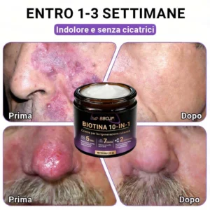 Prodotto e spedito dall’Italia ✨TiworldI® Biotin 10-in-1 Skin Restoration Cream 🍀