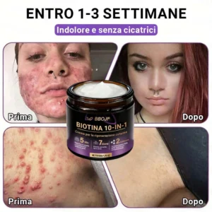 Prodotto e spedito dall’Italia ✨TiworldI® Biotin 10-in-1 Skin Restoration Cream 🍀
