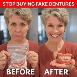 💖 🦷 TIWORLD™ Custom-Fit Dentures ⏰ ENDS TODAY 70% OFF | Smile with Confidence