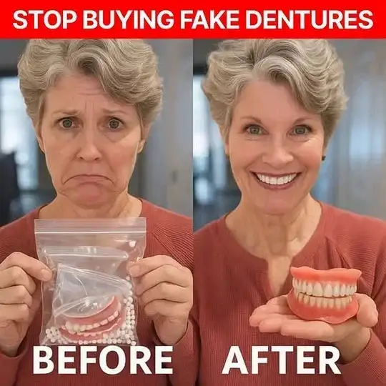 💖 🦷 TIWORLD™ Custom-Fit Dentures ⏰ ENDS TODAY 70% OFF | Smile with Confidence