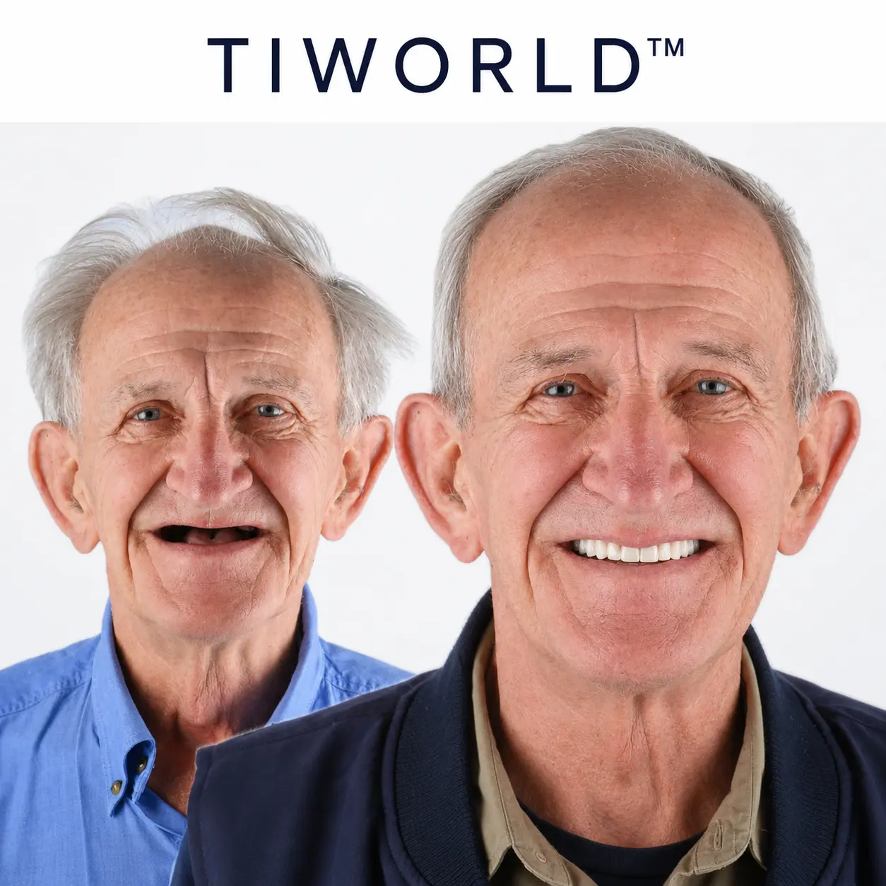 💖 🦷 TIWORLD™ Custom-Fit Dentures ⏰ ENDS TODAY 70% OFF | Smile with Confidence