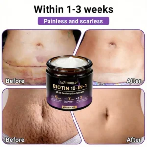Made and Shipped from Canada🍁Tiworld® Biotin 10-in-1 Skin Restoration Cream - Last Day Promotion: 50% OFF