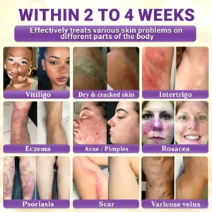 Made and Shipped from Canada🍁Tiworld® Biotin 10-in-1 Skin Restoration Cream - Last Day Promotion: 50% OFF