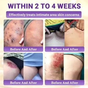 Made and Shipped from Canada🍁Tiworld® Biotin 10-in-1 Skin Restoration Cream - Last Day Promotion: 50% OFF