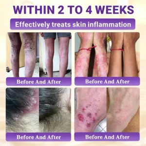 Made and Shipped from Canada🍁Tiworld® Biotin 10-in-1 Skin Restoration Cream - Last Day Promotion: 50% OFF