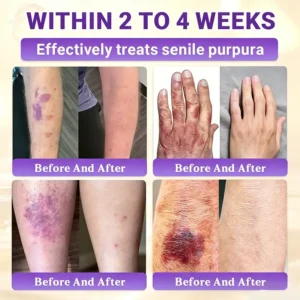 Made and Shipped from Canada🍁Tiworld® Biotin 10-in-1 Skin Restoration Cream - Last Day Promotion: 50% OFF