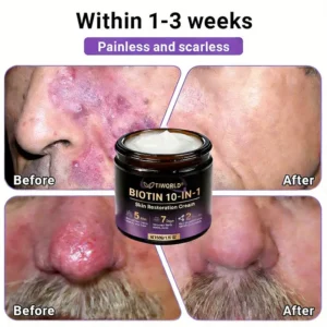 Made and Shipped from Canada🍁Tiworld® Biotin 10-in-1 Skin Restoration Cream - Last Day Promotion: 50% OFF