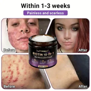 Made and Shipped from Canada🍁Tiworld® Biotin 10-in-1 Skin Restoration Cream - Last Day Promotion: 50% OFF