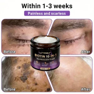 Made and Shipped from Canada🍁Tiworld® Biotin 10-in-1 Skin Restoration Cream - Last Day Promotion: 50% OFF