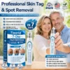 FDA Registered Facility | Tiworld® 7-Day Skin Tag & Spot Eraser Painle
– camelleshop