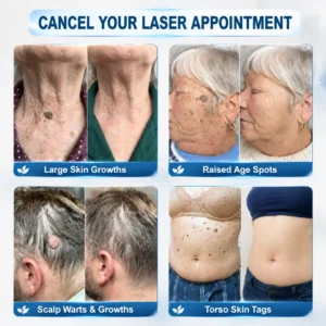 FDA Registered Facility | Tiworld® 7-Day Skin Tag & Spot Eraser Painle
 – camelleshop