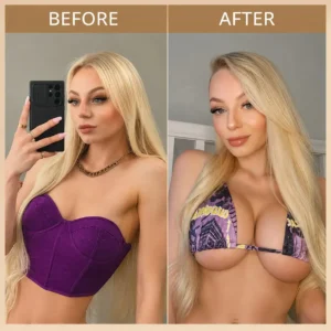 🎀Tiworld® 💥Targeted Breast Enhancement Advanced Nano Microneedle Patch💥💥💥