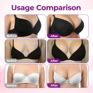 🎀Tiworld® 💥Targeted Breast Enhancement Advanced Nano Microneedle Patch💥💥💥