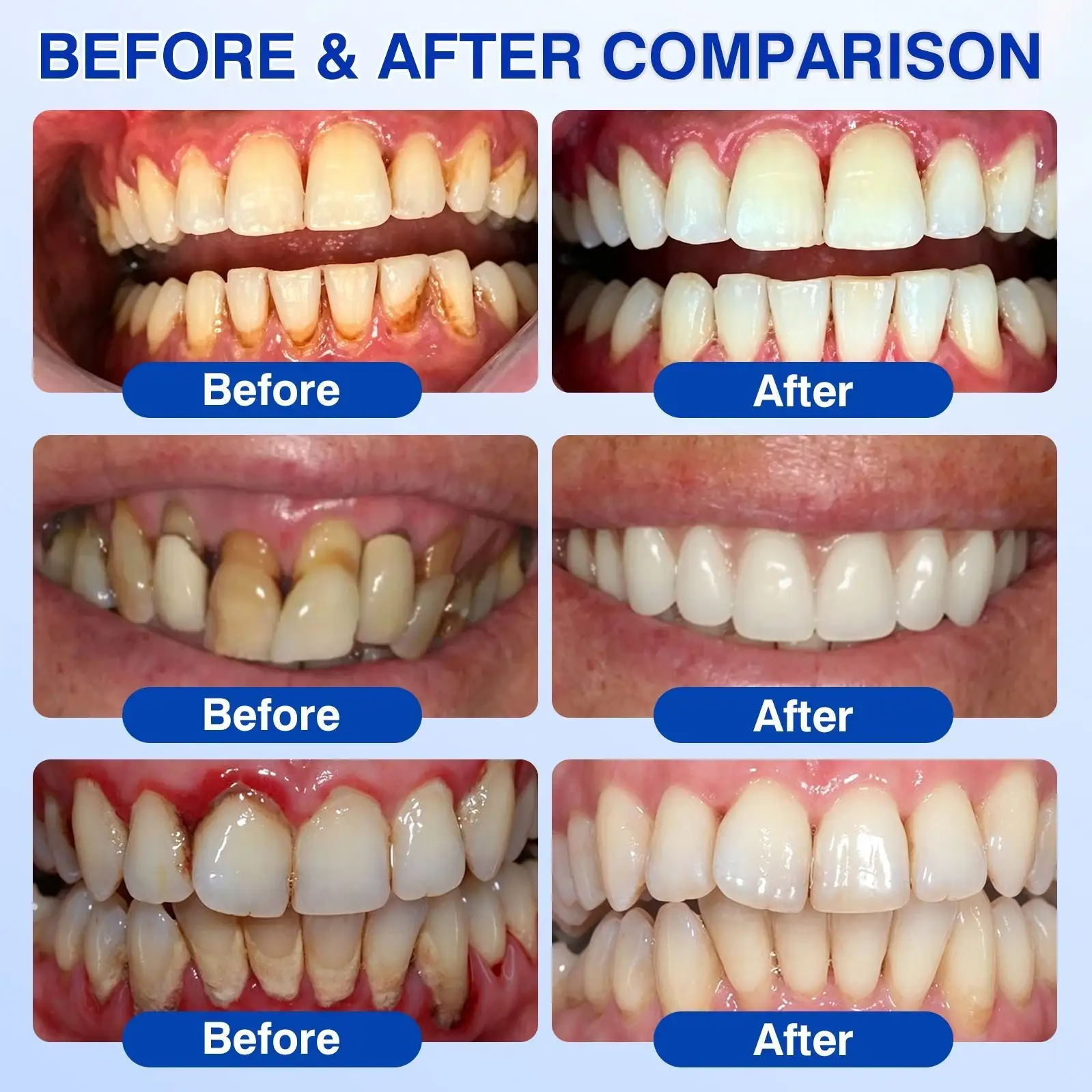 👨⚕️🦷🛡️Tiworld ® Gum health Periodontal Repair Gel