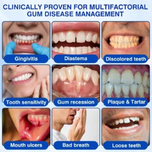 👨⚕️🦷🛡️Tiworld ® Gum health Periodontal Repair Gel