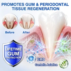 👨⚕️🦷🛡️Tiworld ® Gum health Periodontal Repair Gel