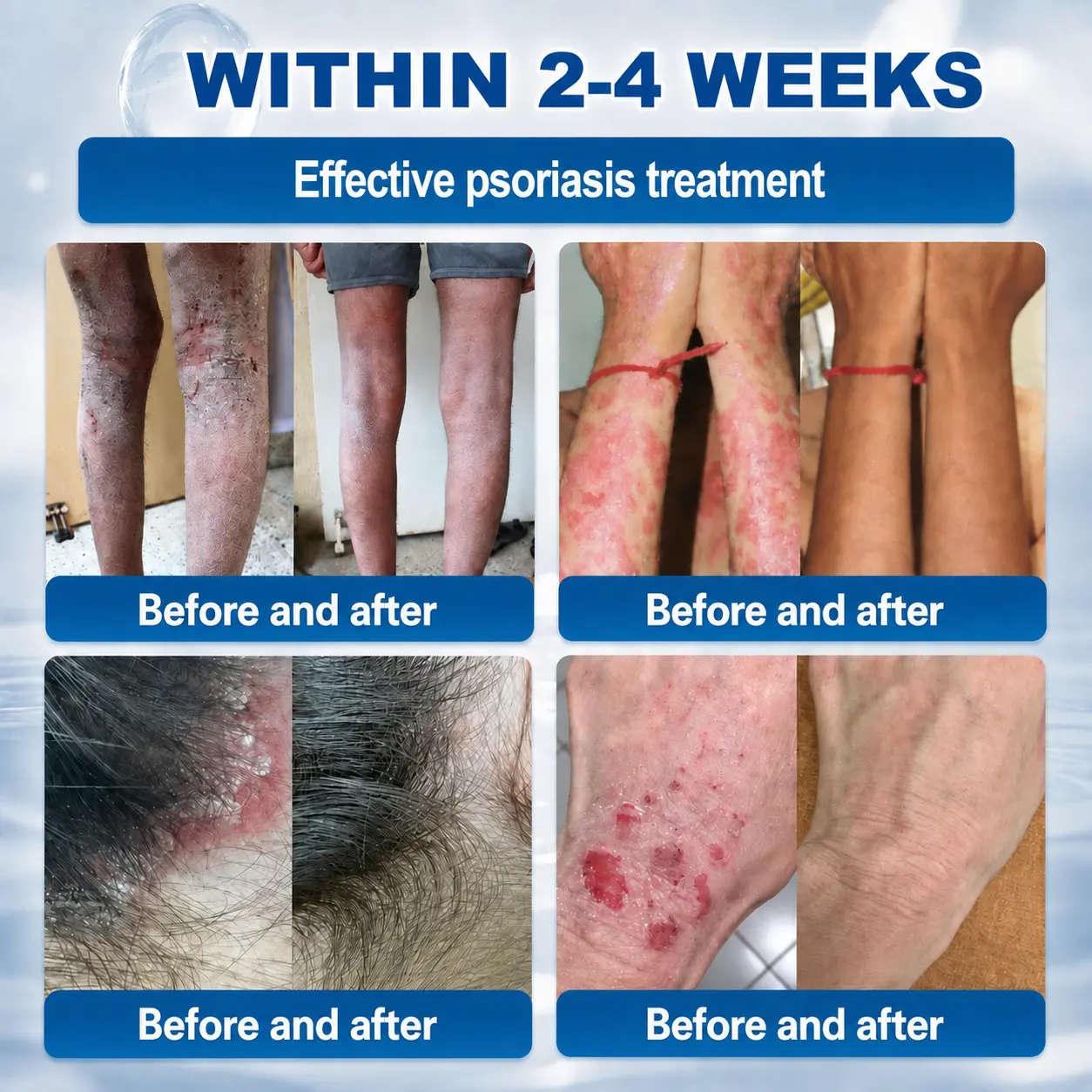 Tiworld® Advanced Corrective Cream for Skin Tags, Moles & Spots – 7-Day Painless, Scar-Free Care for Visible Skin Imperfections