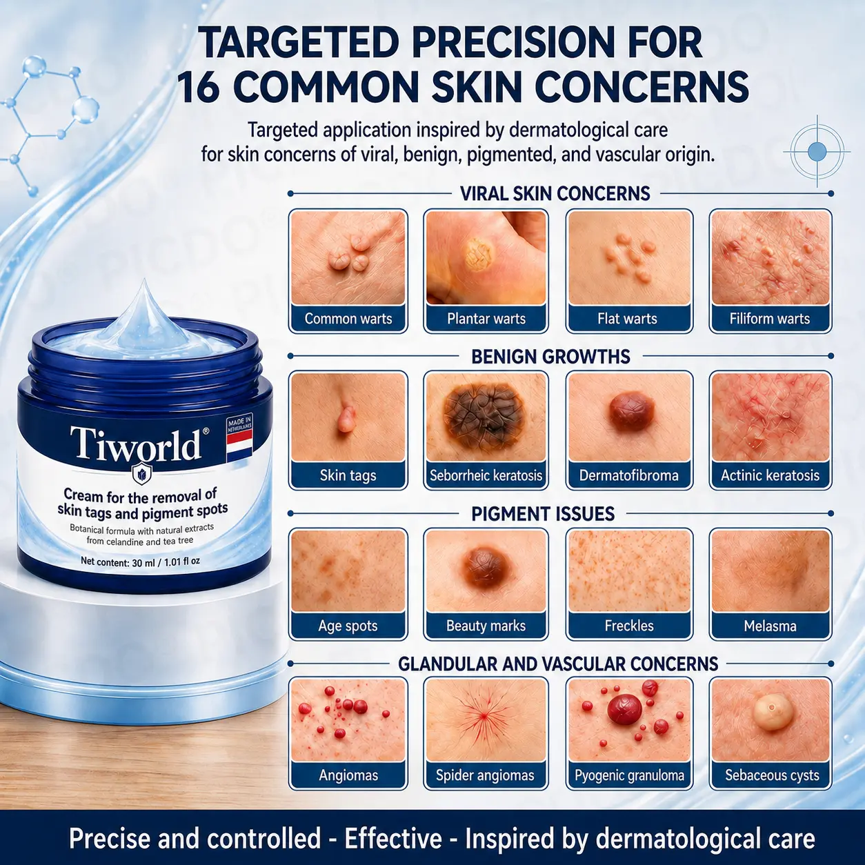 Tiworld® Advanced Corrective Cream for Skin Tags, Moles & Spots – 7-Day Painless, Scar-Free Care for Visible Skin Imperfections