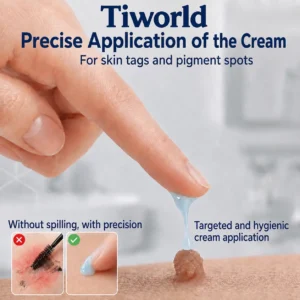 Tiworld® Advanced Corrective Cream for Skin Tags, Moles & Spots – 7-Day Painless, Scar-Free Care for Visible Skin Imperfections