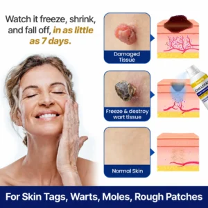 Tiworld® Bump Renewal Spray