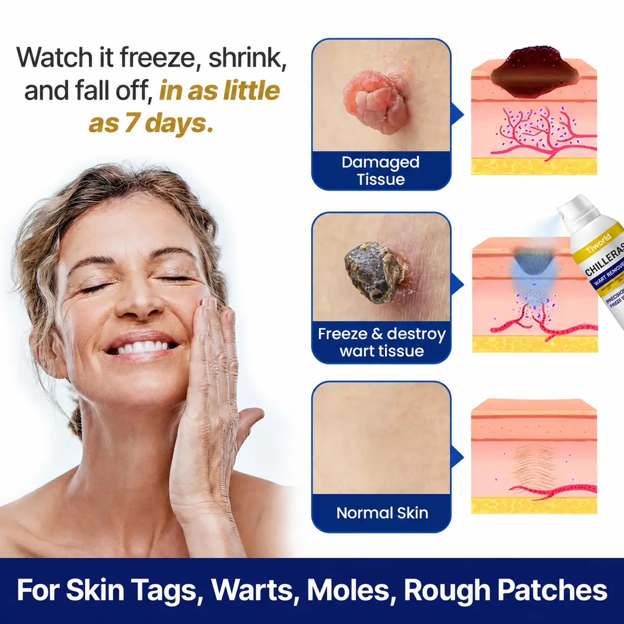 Tiworld® Bump Renewal Spray