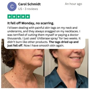 Tiworld® Bump Renewal Spray