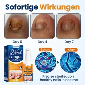 Tiworld® Nail fungus relief spray