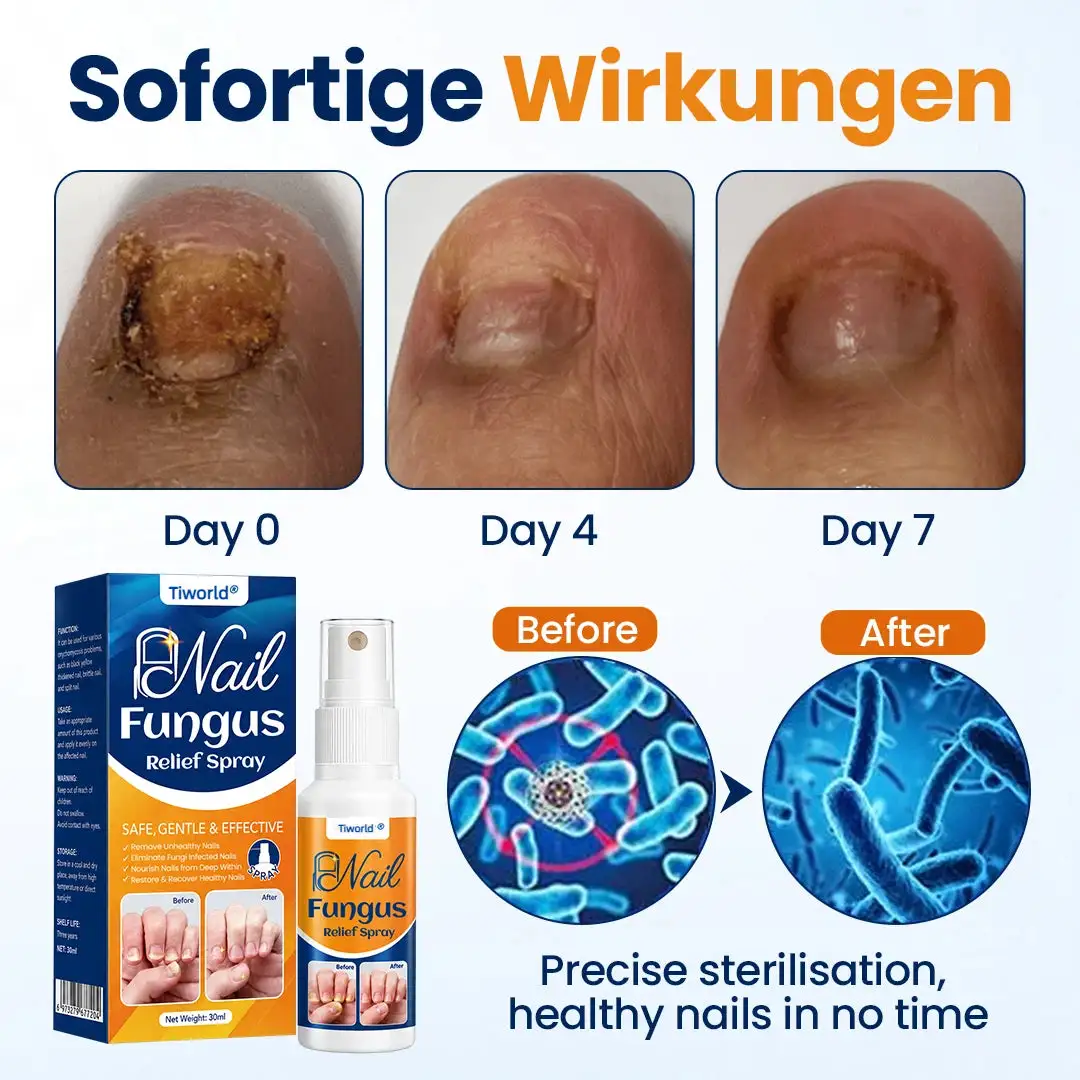 Tiworld® Nail fungus relief spray