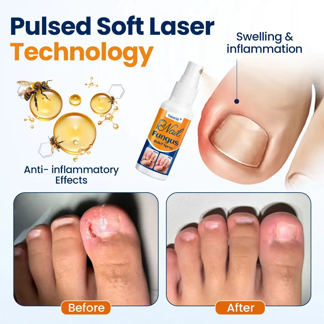 Tiworld® Nail fungus relief spray