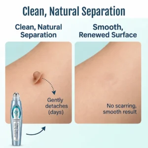 💧Tiworld® SpotlessPro Advanced Skin Care Pen
