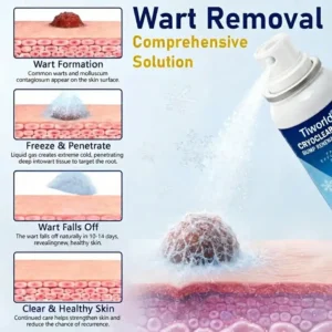 Tiworld® CryoClear Pro Bump Renewal Spray