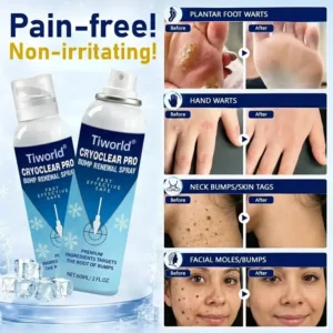 Tiworld® CryoClear Pro Bump Renewal Spray